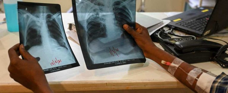 Tuberculosis: WHO welcomes an increase in diagnoses and treatments