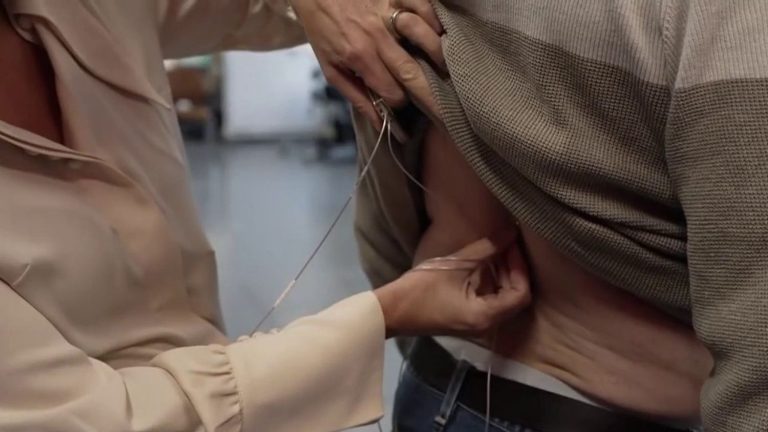 a French patient walks again thanks to electrodes implanted on the spinal cord