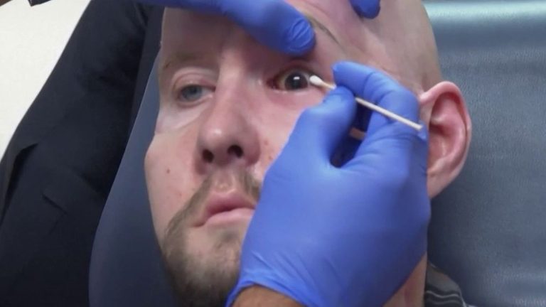 man receives world’s first full eye transplant