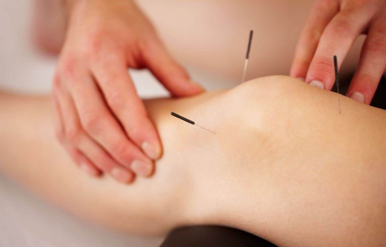 Montreal Public Health is investigating a fake acupuncturist