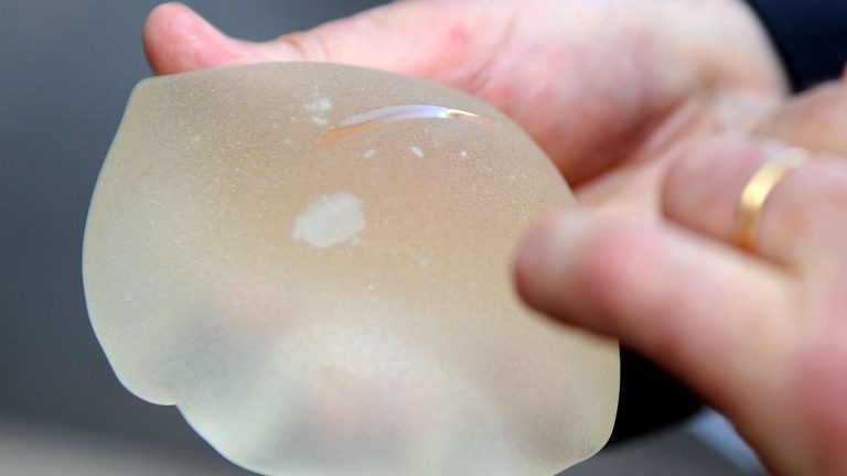 The certifier of defective PIP breast prostheses will have to compensate 605 women