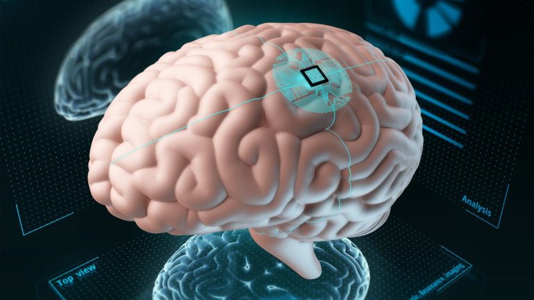 The race for brain implants to control machines with thought