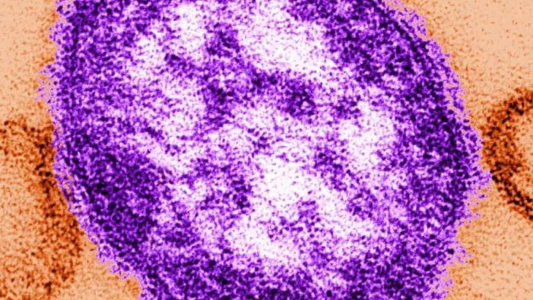 Florida and measles: please move backwards