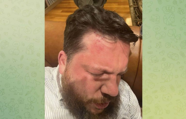 Leonid Volkov, former right-hand man of Navalny, violently attacked in Lithuania