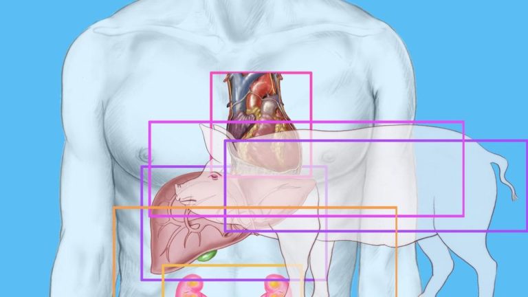 with the successful transplant of a pig kidney into a human, a horizon opens up for biotechnology firms