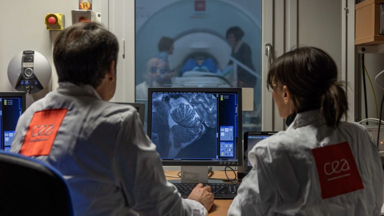 Iseult, the most powerful MRI in the world, unveils its first images in France