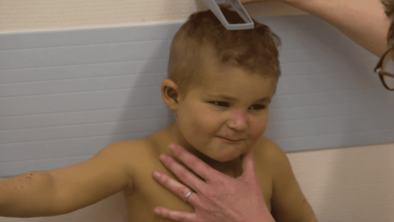 Côme, 3 years old, awaits his liver transplant