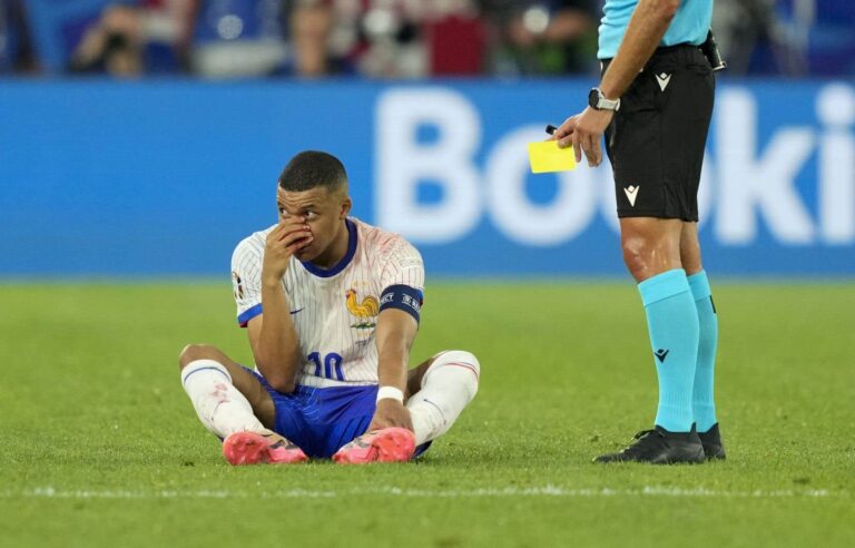 France beats Austria 1-0 at Euros, but loses Kylian Mbappé after broken nose