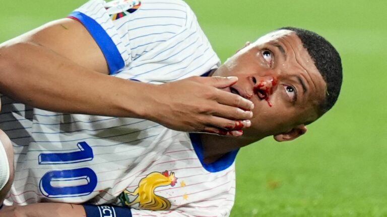 concerns for Kylian Mbappé, hit in the nose after a clash with the Austrian Kevin Danso