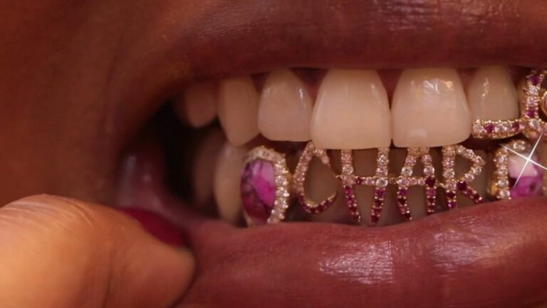 dental jewelry is particularly popular across the Channel