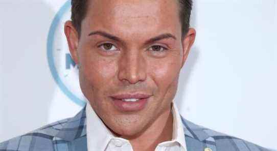 Bobby Norris de TOWIE partage qu'il a fait dissoudre ses charges faciales après avoir trollé