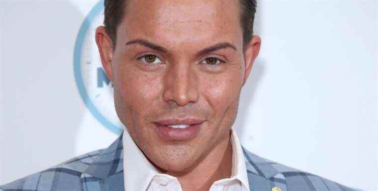 Bobby Norris de TOWIE partage qu'il a fait dissoudre ses charges faciales après avoir trollé

