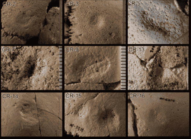 Ces exemples montrent à quoi ressemblent des fractures dépressives cicatrisées.