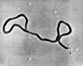 C'est l'image la moins odieuse de la syphilis que l'on puisse trouver.  Malheureusement, la maladie transmise sexuellement, vieille de plusieurs siècles, connaît un certain renouveau au Canada en ce moment.  Cliquez ici pour en savoir plus.