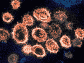 Par rapport à la souche d'origine, les variants du SRAS-CoV-2 ont été plus infectieux, plus virulents, plus résistants à l'immunité naturelle ou induite par le vaccin, ou une combinaison des trois.