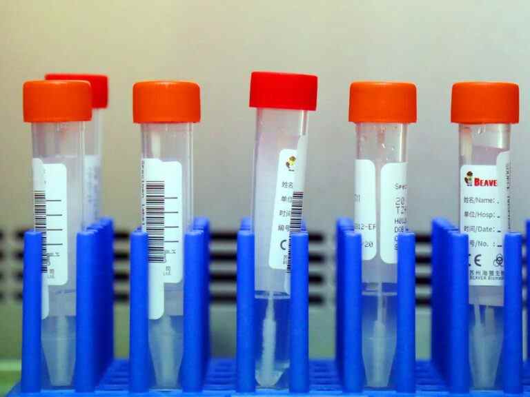 L’ARC décide si deux avantages en milieu de travail sont des avantages imposables ou non