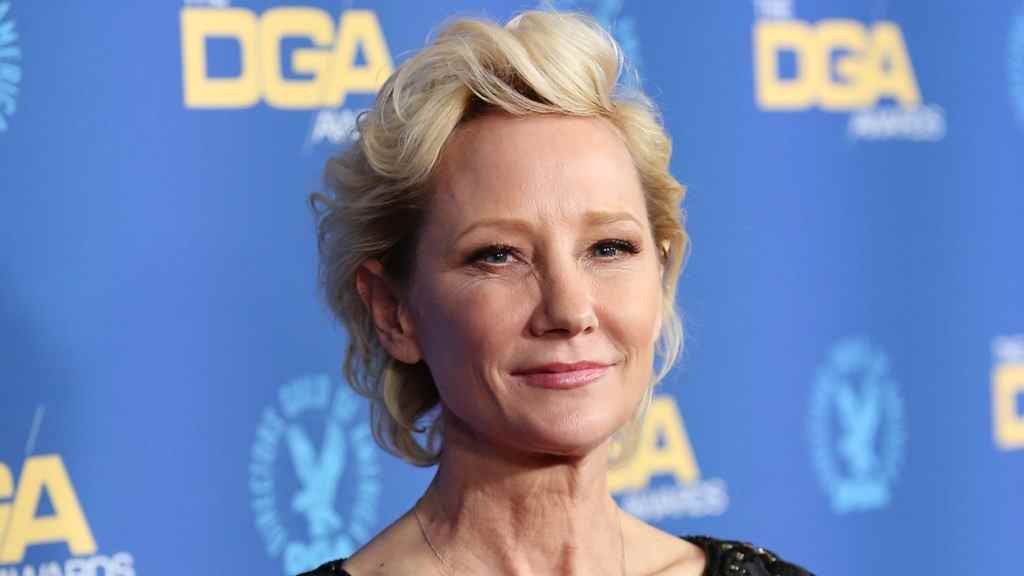 Anne Heche hospitalisée après un incendie dans un accident de voiture à Los Angeles
