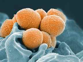 Cette image de document fournie par l'Institut national des allergies et des maladies infectieuses montre une image au microscope électronique du streptocoque du groupe A (orange) lors d'une interaction phagocytaire avec un neutrophile humain (bleu).  Les mêmes bactéries qui causent une angine streptococcique simple déclenchent parfois des infections sanguines ou même mangeuses de chair, et au fil des ans, les cas dangereux ont augmenté.