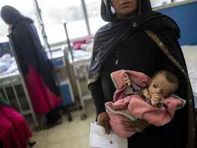 Une femme afghane tient sa fille de 5 mois dans le service de malnutrition de l'hôpital pour enfants Indira Gandhi, à Kaboul, en Afghanistan.