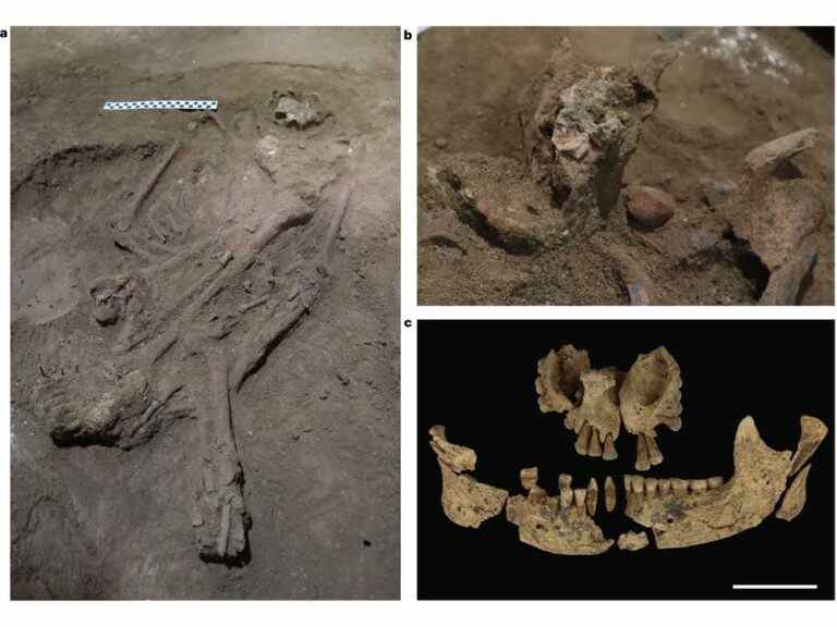 Le pied manquant du squelette de l’âge de pierre peut montrer l’amputation la plus ancienne