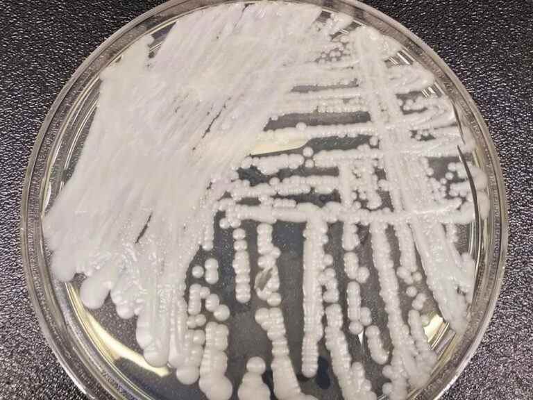 Un champignon Candida auris dangereux détecté dans un hôpital de la région de Montréal, selon des responsables de la santé