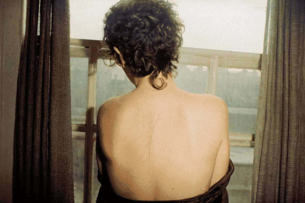 Une Nan Goldin d'âge moyen aux cheveux courts se tenant devant une fenêtre, se détournant de la caméra, montrant plusieurs cicatrices sur son dos dans All the Beauty and the Bloodshed