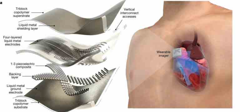 Un patch à ultrasons portable pourrait offrir des analyses cardiaques en temps réel lors de vos déplacements