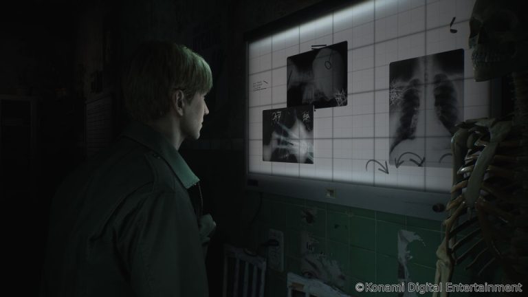 L’équipe de développement de Silent Hill 2 Remake Bloober ne va « pas dire jamais » de travailler sur d’autres jeux Silent Hill