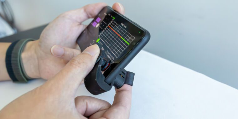 L’accessoire pour smartphone ultra économique mesure la tension artérielle à domicile