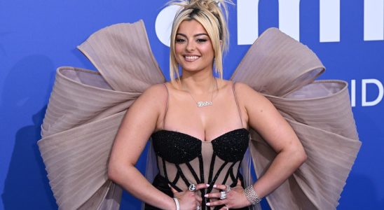 Bebe Rexha partage une photo de blessure au visage après avoir été frappée par téléphone lors d'un concert à New York