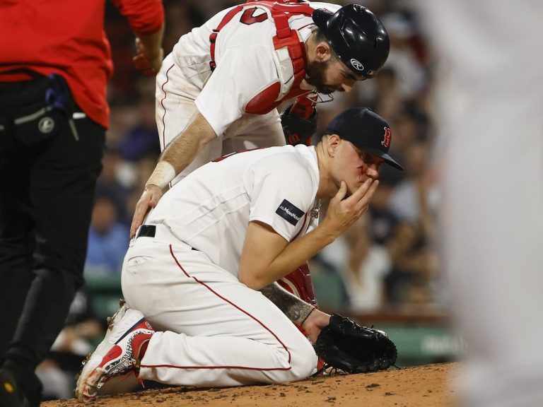 Les Red Sox ne savent pas si le lanceur Tanner Houck a besoin d’une intervention chirurgicale après un entraînement en ligne au visage