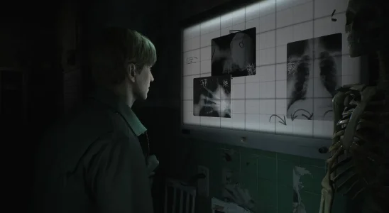 Silent Hill 2: James Sunderland looking at some X-rays.