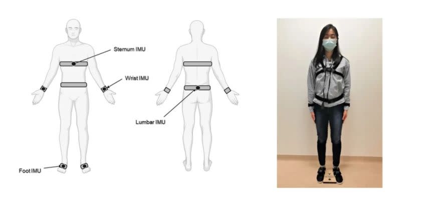 Les capteurs portables permettent une détection précoce de la progression de la maladie de Parkinson.