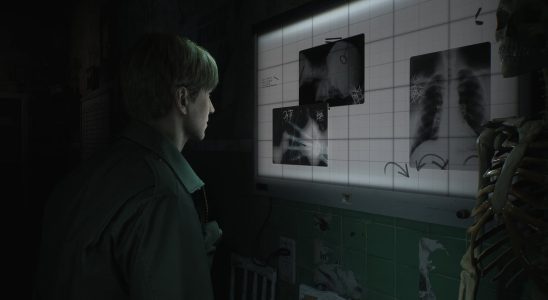 L'équipe Bloober demande de la patience aux fans sur Silent Hill 2 Remake et affirme que les choses "avancent sans problème"