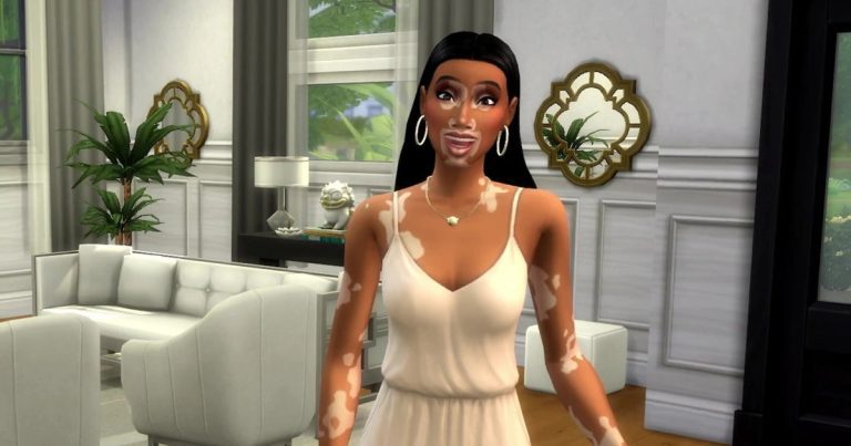 La mise à jour gratuite des Sims 4 ajoute des détails sur la peau du vitiligo avec la collaboration de Winnie Harlow
