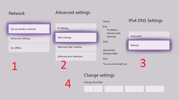 modifier les paramètres du serveur DNS sur Xbox One