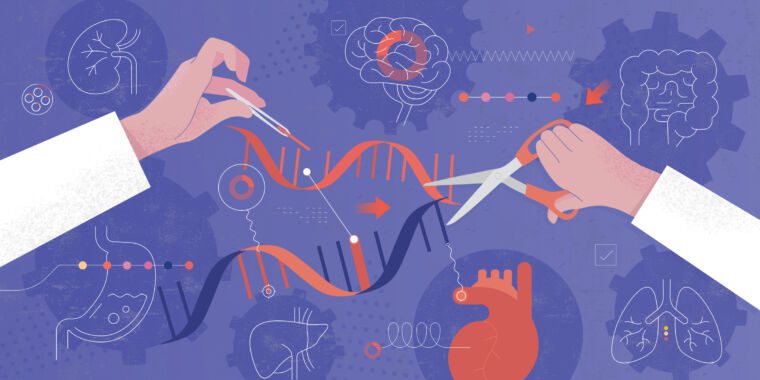 La perfusion IV permet de modifier le gène de la mucoviscidose dans les cellules souches pulmonaires