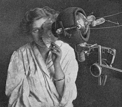 L’utilisation des radiations pour tuer les cellules cancéreuses existe depuis longtemps.  Sur cette photo de 1915, une femme reçoit une « radiothérapie » – un traitement aux rayons X – visant un cancer des cellules épithéliales de son visage.