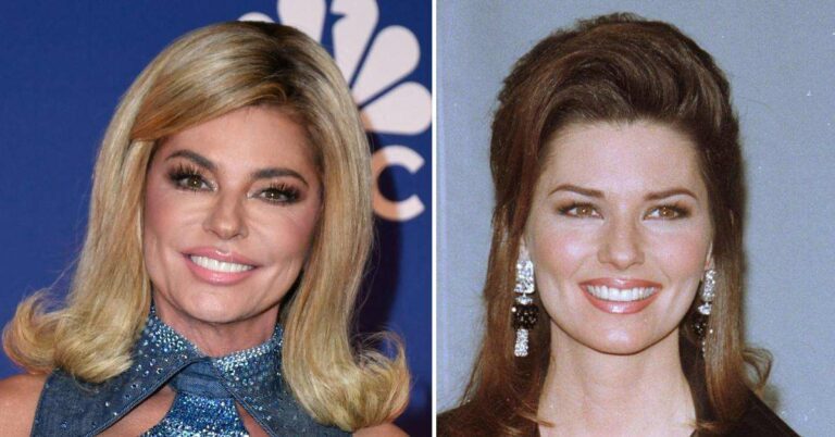 Les révélations des experts en chirurgie esthétique sur l'apparence transformée de Shania Twain aux People's Choice Awards